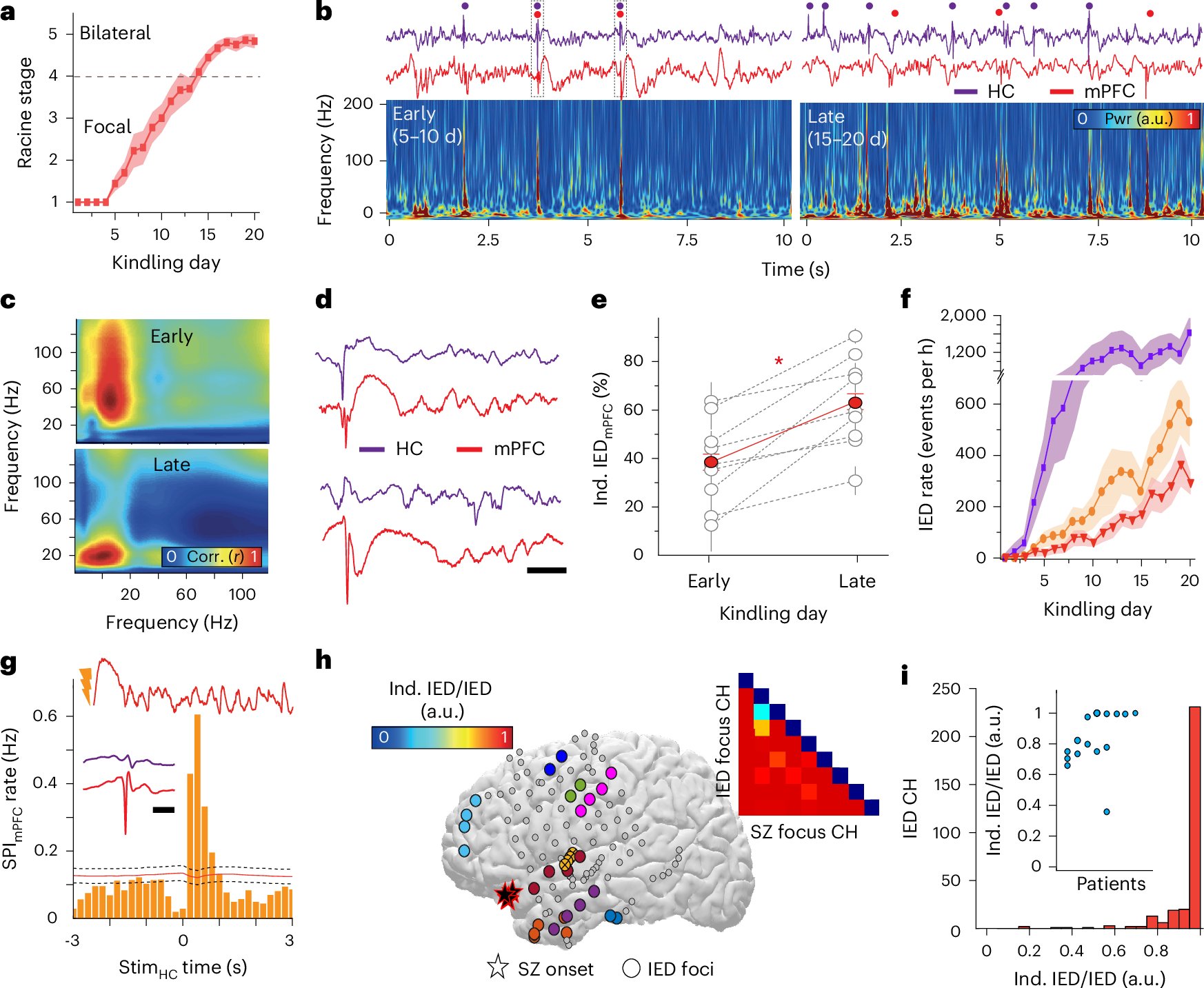 NatureNeuro's tweet card. Nature Neuroscience - Pathological neural communication drives the spread of the epileptic network and contributes to memory impairment in focal epilepsy. The authors show that closed-loop...