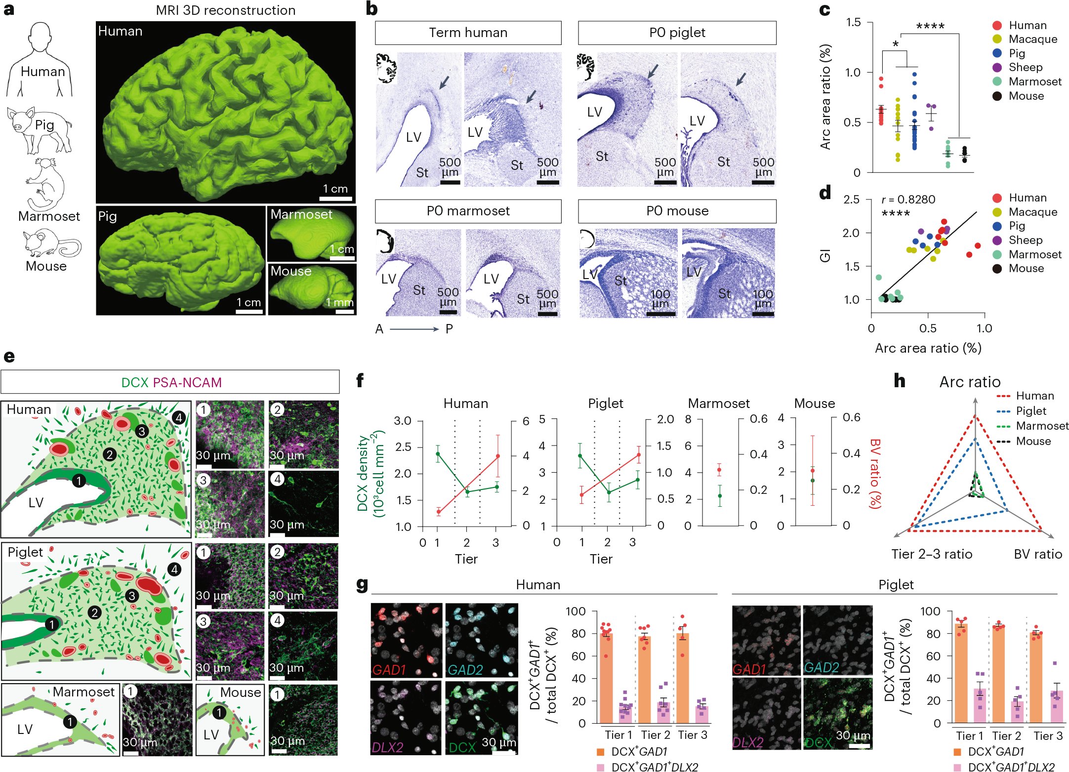 NatureNeuro's tweet card. Nature Neuroscience - Neonatal gyrated brains harbor an elaborate subventricular zone, termed the Arc, supporting cortical migratory streams of diverse interneurons.