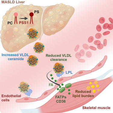 MattWattUnimelb's tweet card. Anari et al. show that hepatic accumulation of phosphatidylserine (PS) is associated with hypertriglyceridemia in metabolic dysfunction-associated steatohepatitis (MASH). Increasing expression of PS...