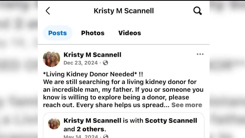 StonyBrookMed's tweet card. Scott underwent his life-saving kidney transplant at Stony Brook University Hospital in April. Ann Marie Hassett heard about the urgent need for organ donors and the struggles they faced and wanted...