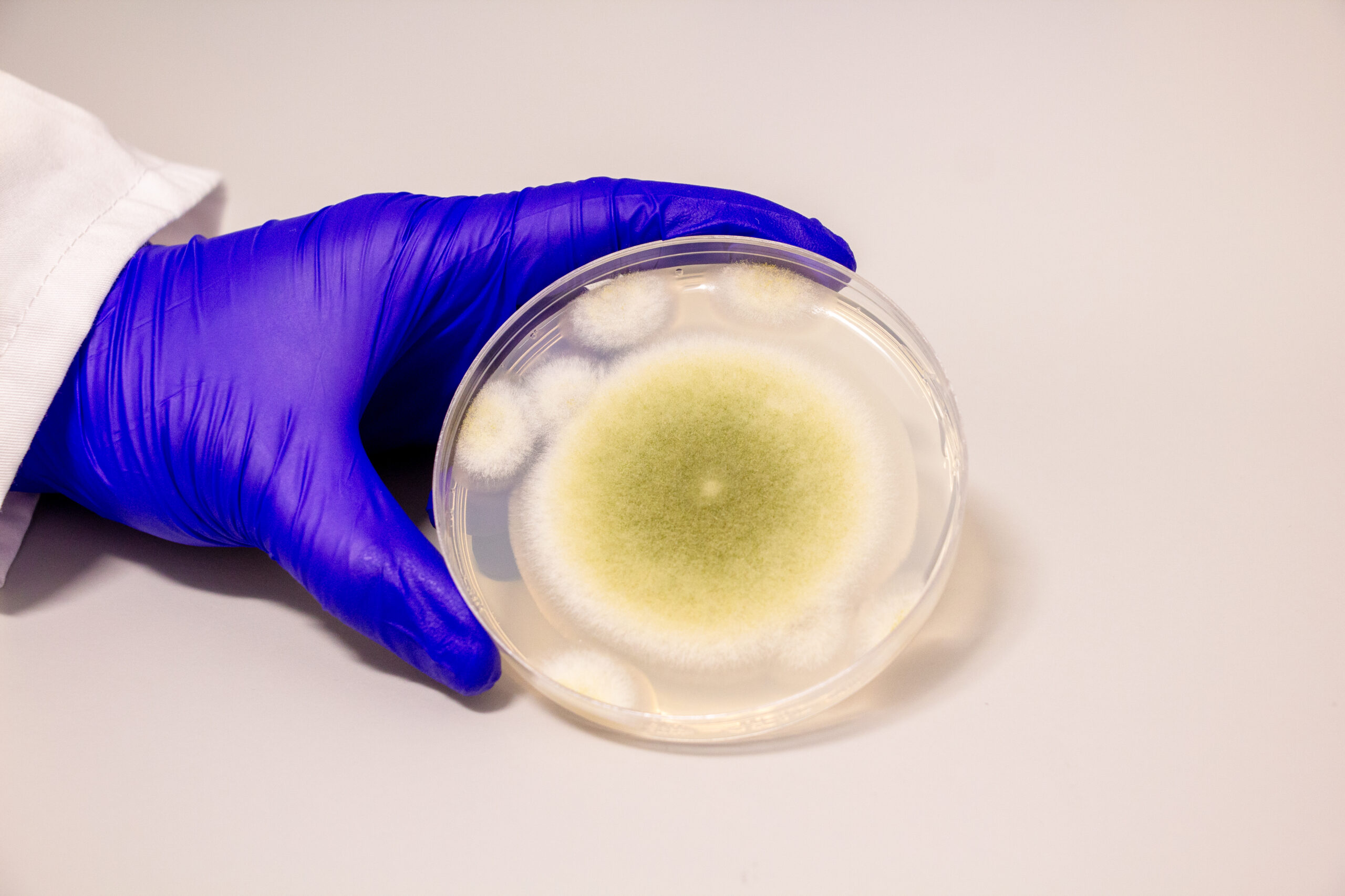 WeissmanLab's tweet card. Penn-led researchers have turned a deadly fungus into a potent cancer-fighting compound. After isolating a new class of molecules from Aspergillus flavus, a toxic crop … Read More ›