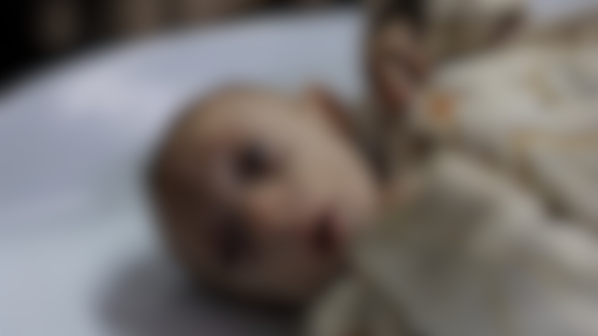 kritica_news's tweet card. La malnutrizione a Gaza dovuta all’affamamento forzato imposto da Israele sta rendendo quasi impossibile la sopravvivenza dei neonati.