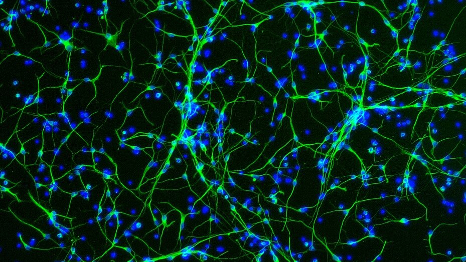 VTNeuroLabs's tweet card. Researchers identified a gene that seems to help slow brain aging in women, and studied links between hormone therapy, menopause and Alzheimer’s.