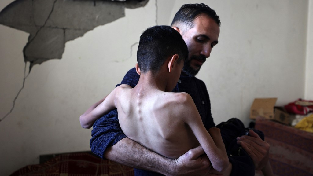 oscarrickettnow's tweet card. Across the besieged territory, an increasing number of Palestinians are dying from Israel's brutal policy of withholding food