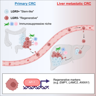 CellGenomics's tweet card. Ogden and colleagues reveal regenerative and inflammatory cancer cell states in primary and metastatic colorectal cancer. They combine single-cell multiomics and spatial transcriptomics patient data...