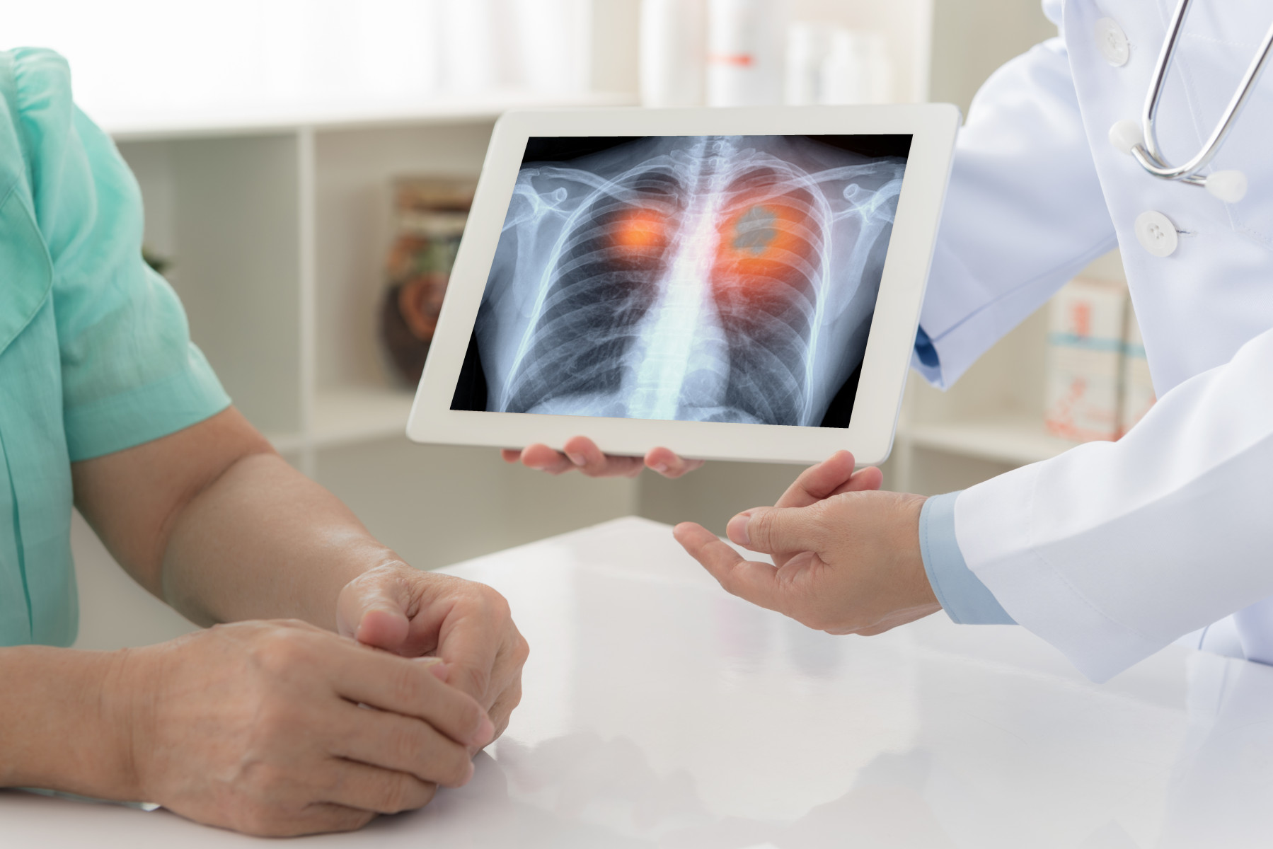 KECKSchool_USC's tweet card. LOS ANGELES — Corticosteroids, a commonly prescribed medication to alleviate cancer-related symptoms for non-small cell lung cancer patients treated with immunotherapy, are the main reason certain...