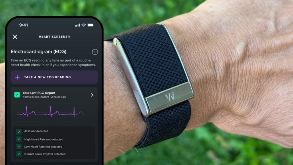 Outside_Run's tweet card. With ECG, blood pressure insights, and a sleek redesign, Whoop’s new MG delivers the deepest health tracking yet—but is it worth the hefty price tag?