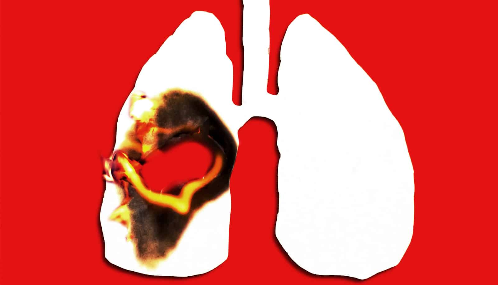 FuturityNews's tweet card. Researchers have discovered a hidden "molecular seesaw" behind drug resistance in certain types of lung cancer.