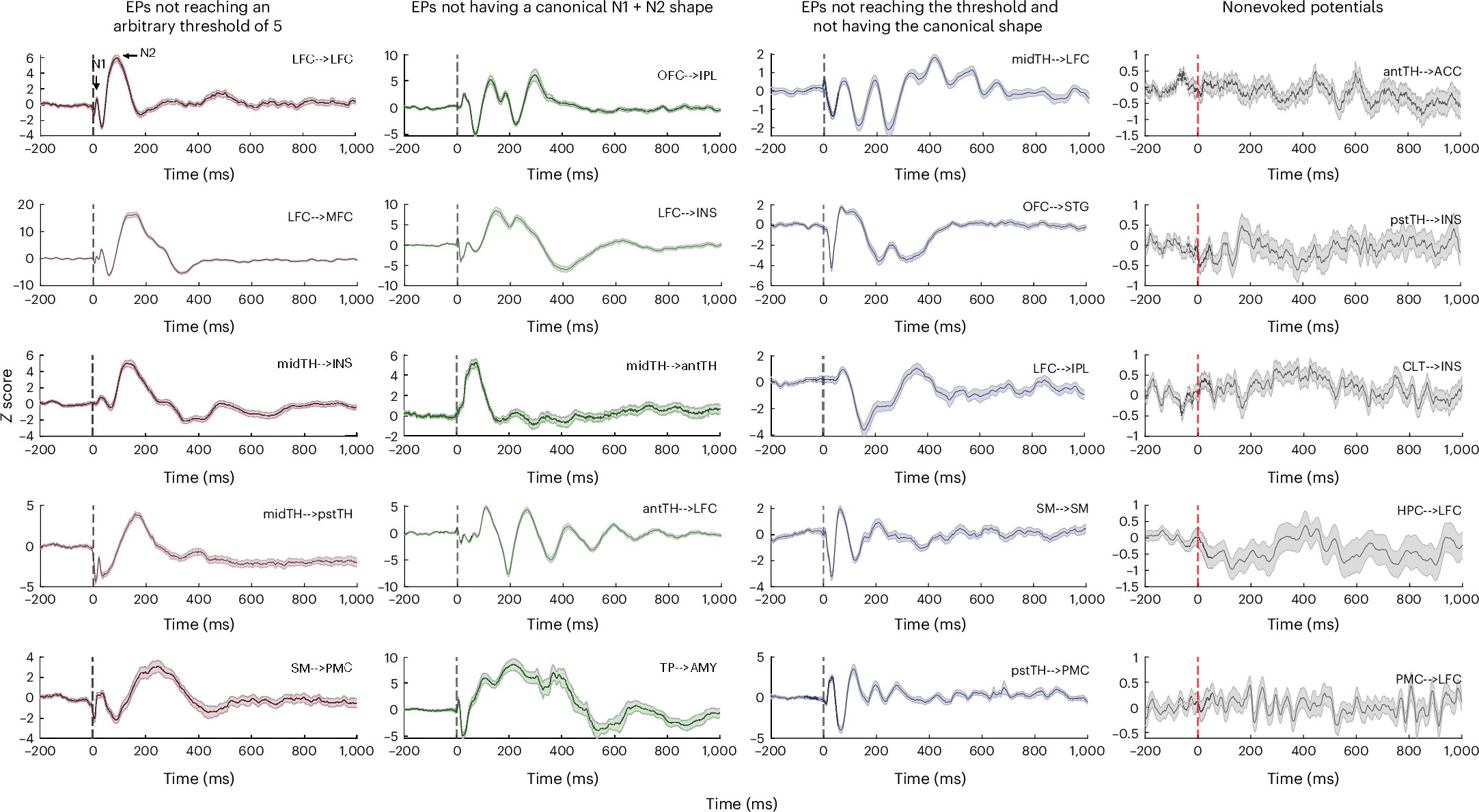 NatureNeuro's tweet card. Nature Neuroscience - Intracranial stimulation maps human brain causal connectivity, uncovering distinct pathways. The authors show that thalamic pulses uniquely evoke delayed theta oscillations,...