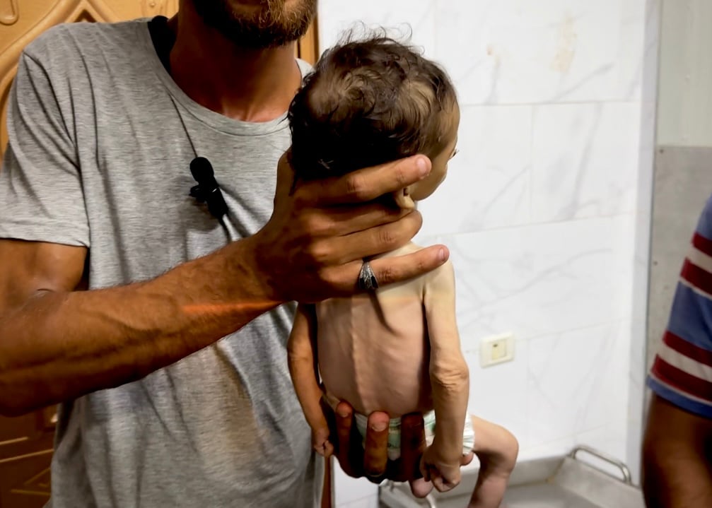 AliceTinker1943's tweet card. Children in Gaza have begun to die of severe malnutrition in increasing numbers as Israel continues to starve the people of Gaza. Infants are the most severely affected, as hunger devours their...