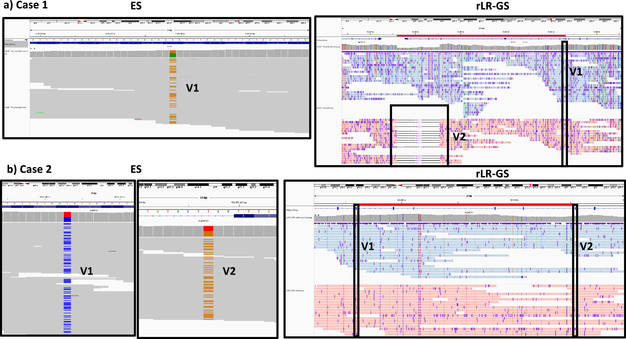 ejhg_journal's tweet card. European Journal of Human Genetics - Singleton rapid long-read genome sequencing as first tier genetic test for critically Ill children with suspected genetic diseases