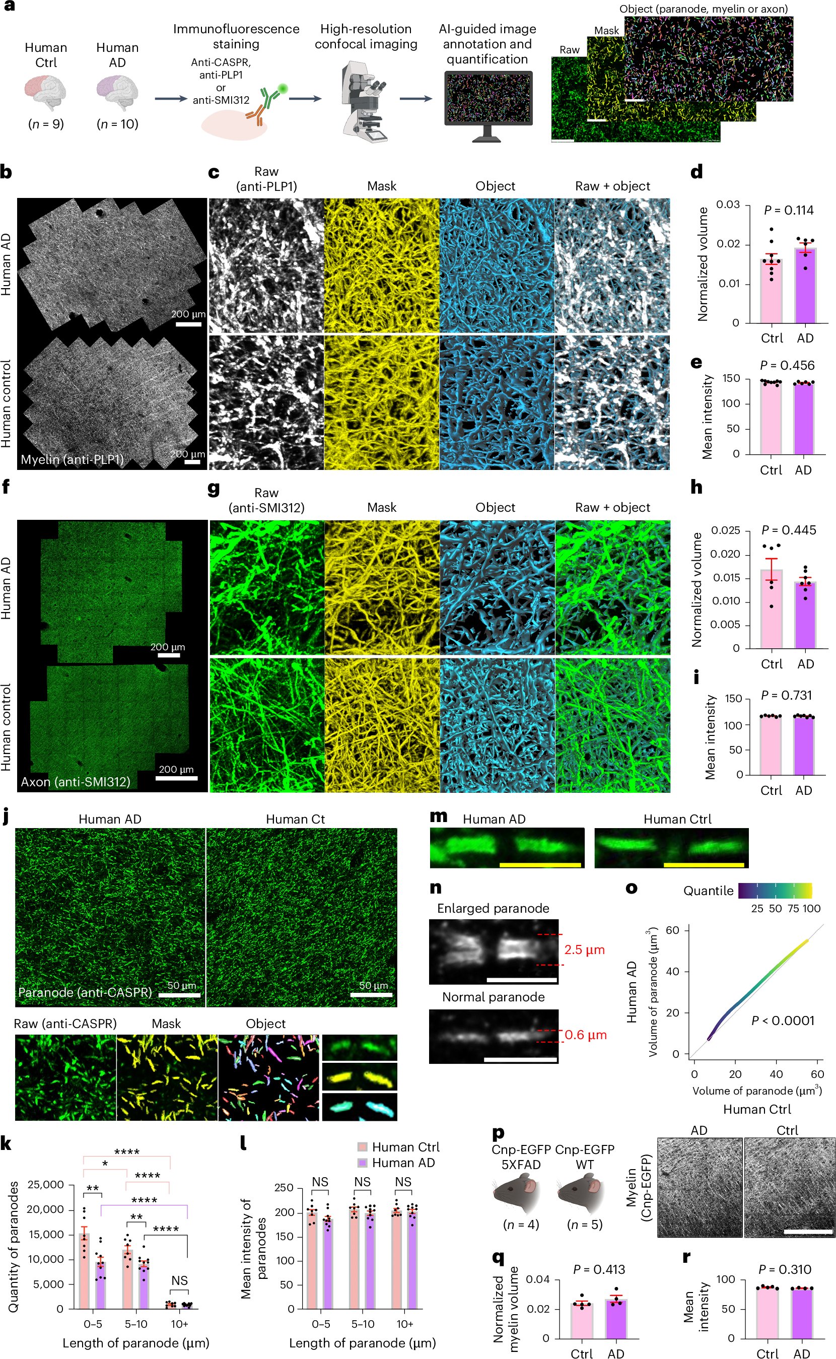 HeatherAlz's tweet card. Nature Neuroscience - In Alzheimer’s disease (AD), disruptions in myelin and axonal structures occur, although the underlying mechanisms remain unclear. Here the authors show that, at the...
