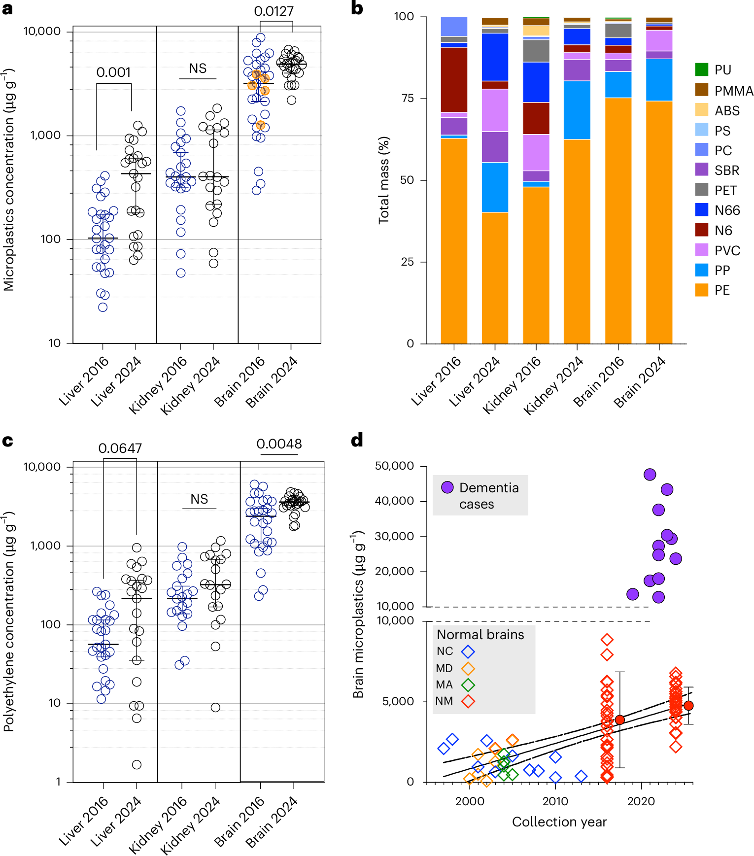 DrMicrobiome's tweet card. Nature Medicine - Pyrolysis gas chromatography–mass spectrometry reveals the presence of microplastics and nanoplastics in human kidney, liver and brain tissue samples from 2016 and 2024,...