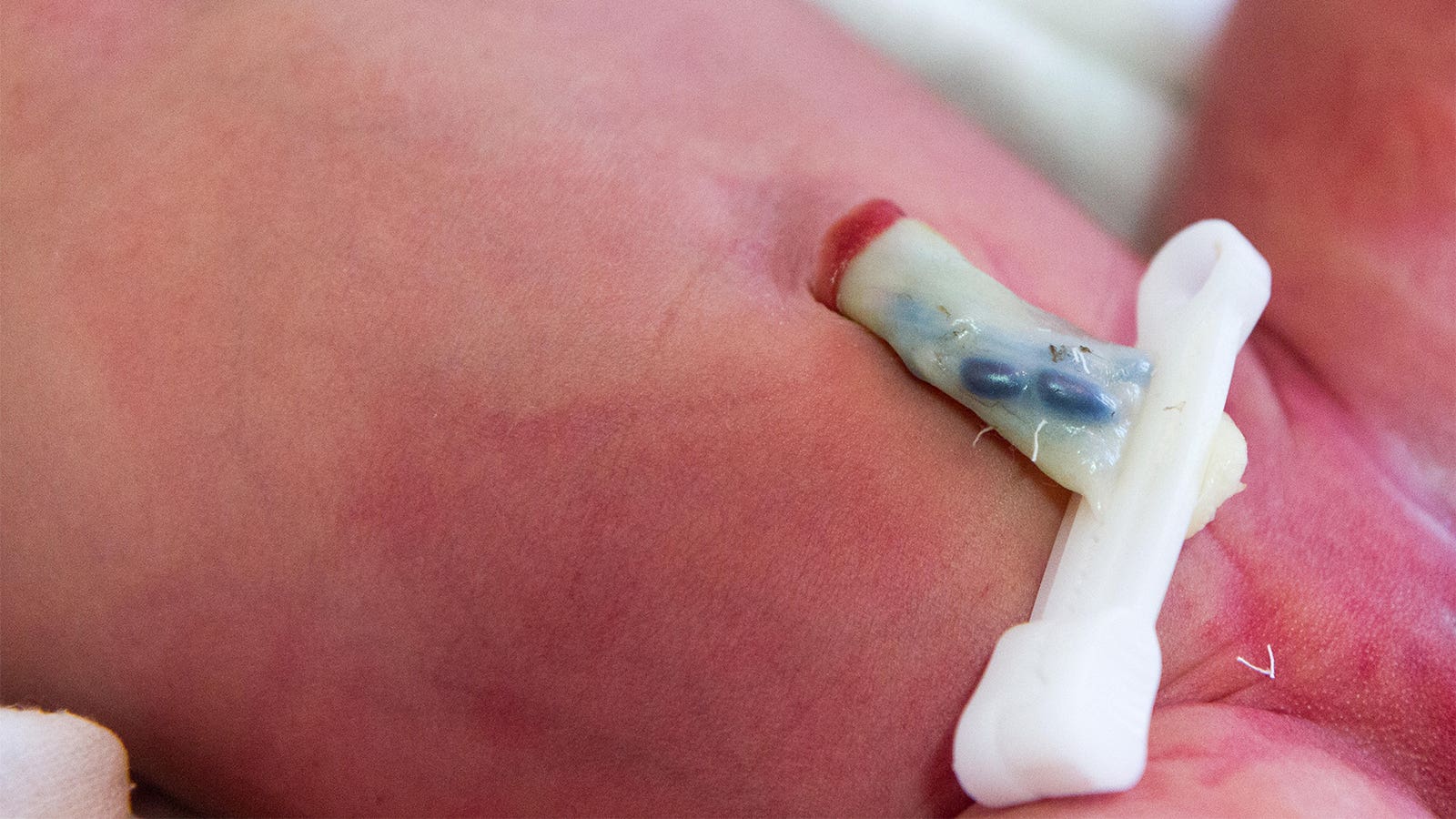 NICU_Musings's tweet card. Pilot randomized trial shows safety and reduced early hypoxemia