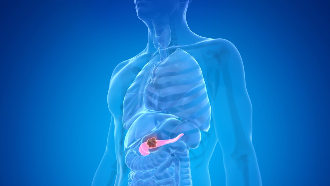 ndorms's tweet card. Study shows why there are differences in prognosis between different pancreatic tumours and identifies potential avenues for improved treatment approaches.