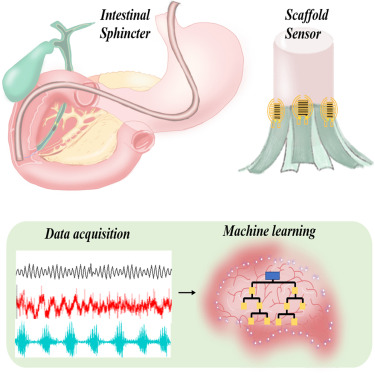 CellPressNews's tweet card. Wang et al. present a Janus adhesive hydrogel scaffold with an inverse opal microstructure that provides adhesion in the intestinal environment. The integrated multi-channel sensor system can capture...