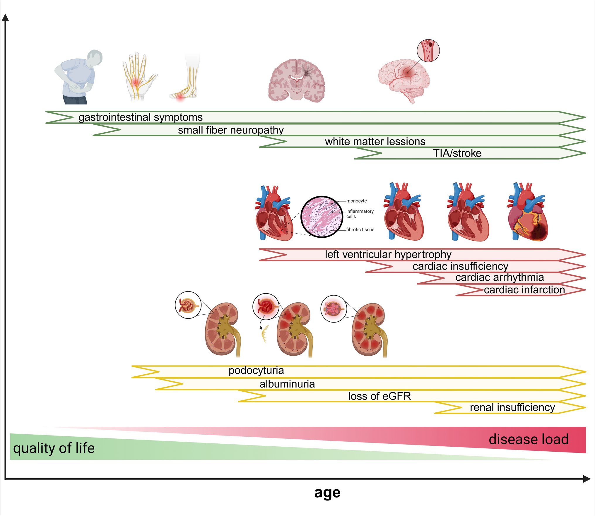 BioDrugsJournal's tweet card. BioDrugs - Fabry disease is a rare but life-threatening, X-linked, inherited lysosomal storage disorder in which globotriaosylceramide is insufficiently metabolized because of reduced...