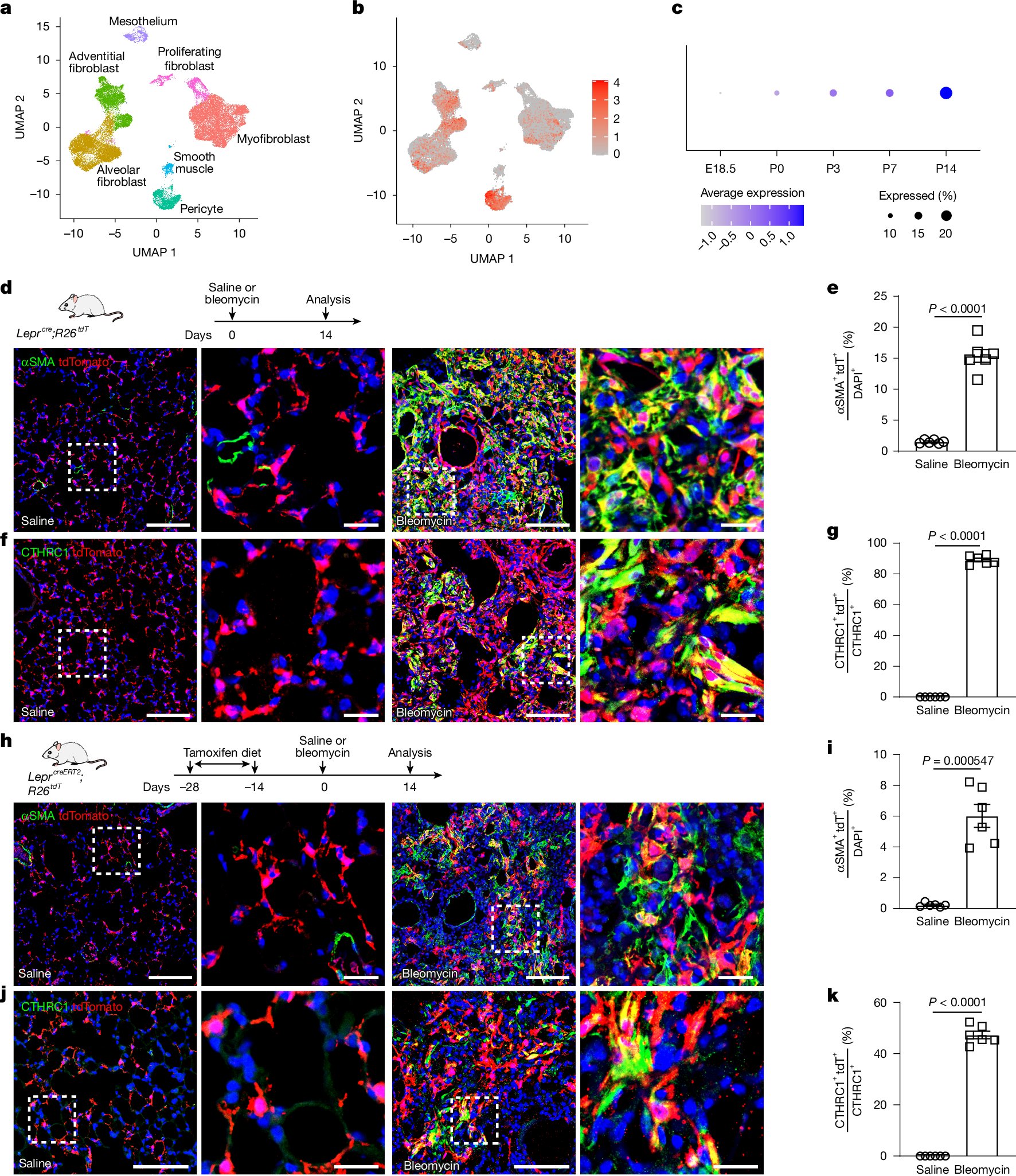 TatsuyaTsukui's tweet card. Nature - The use of two mouse models of pulmonary fibrosis helped the identification of the transcription factor RUNX2 as a regulator of the transition of alveolar fibroblasts to pathological...