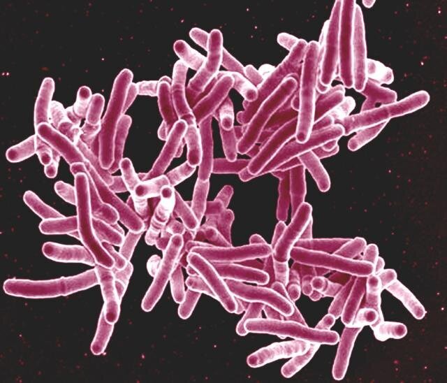 stefan_niemann's tweet card. For some forms of tuberculosis, the chances that an exposed person will become infected depend on whether the individual and the bacteria share a hometown, according to a new study comparing how...