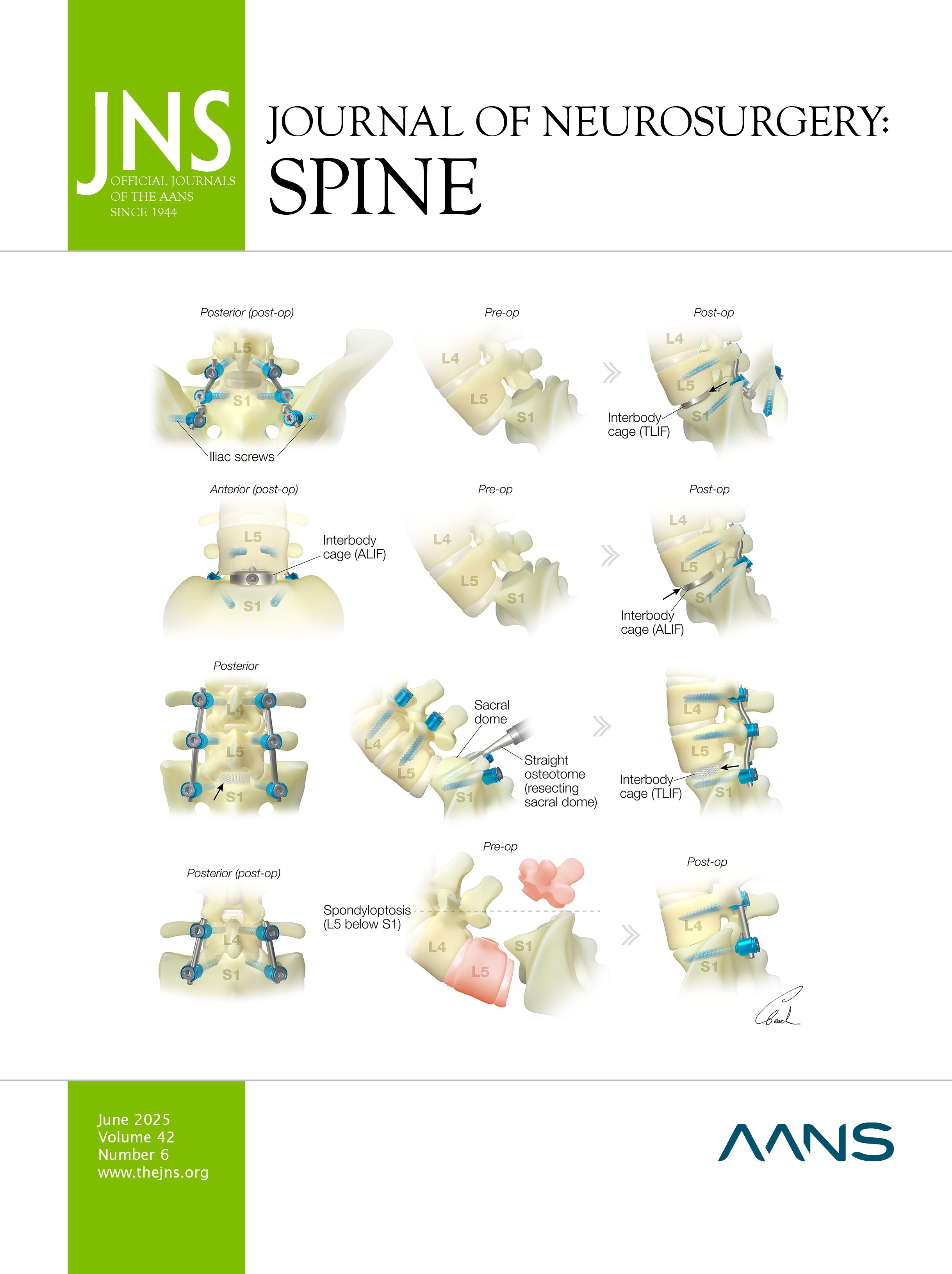 spinesection's tweet card. OBJECTIVE Previous research suggests elective surgical procedures performed later in the week have worse outcomes. This study investigated whether the day of the week on which elective anterior...