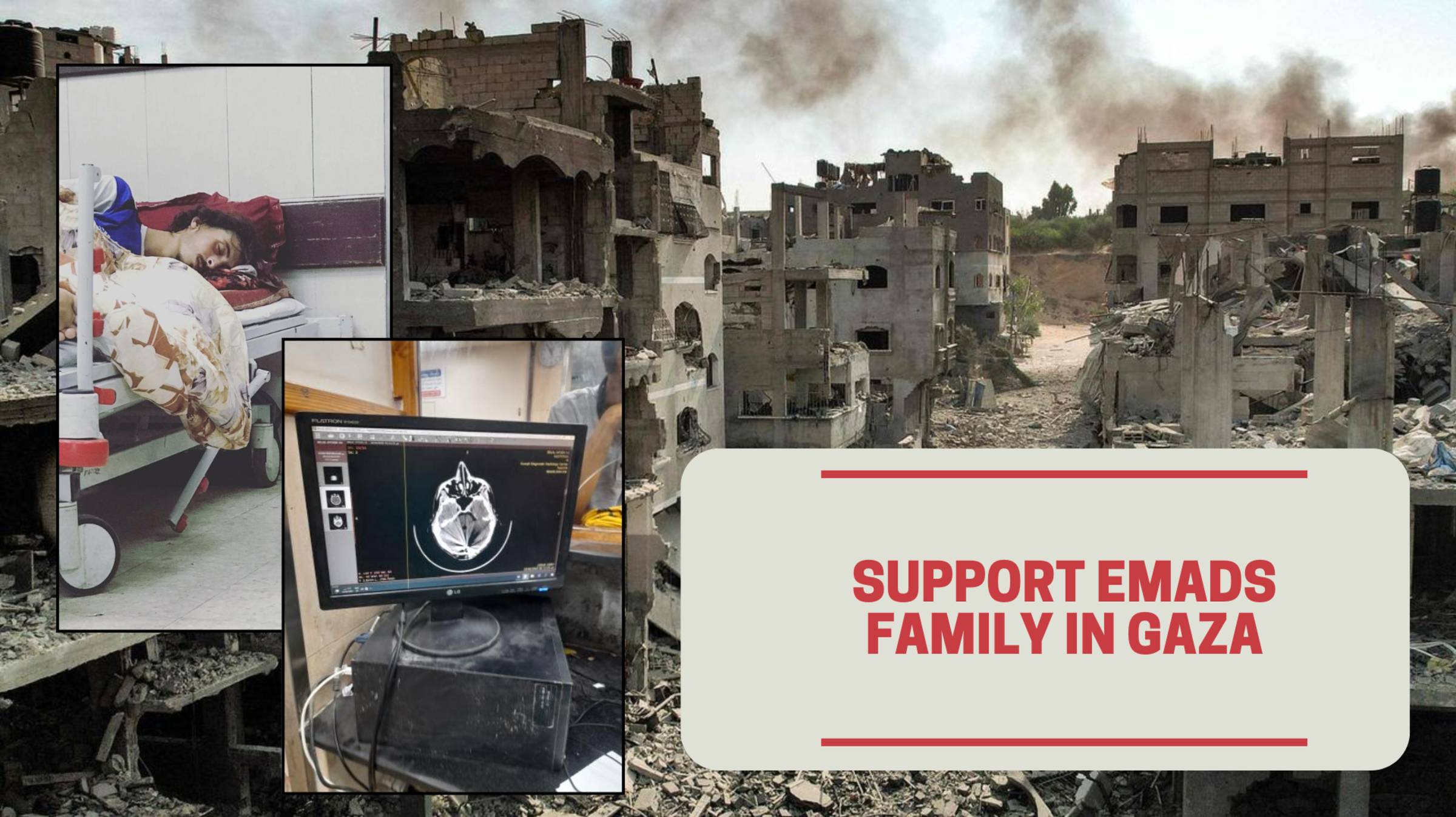 emad_r_e_r's tweet card. 🆘 Urgent: Help Save Bilal’s Life After Devastating Head Injury in Gaza