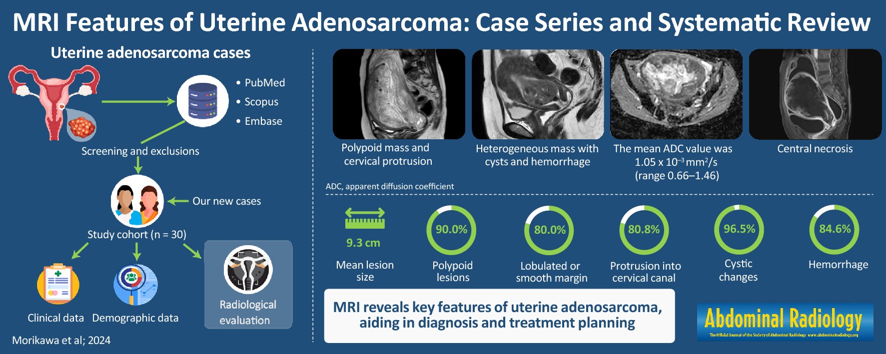 Abdominal_Rad's tweet card. Abdominal Radiology - To comprehensively summarize the characteristics of magnetic resonance imaging (MRI) findings of uterine adenosarcoma through a systematic review and case series analysis. A...