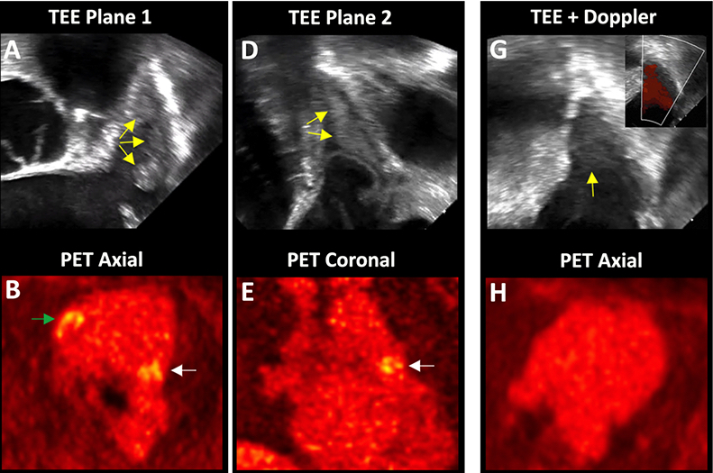AnciraBecky's tweet card. Project Summary: The project is the first in the world to use advanced positron emission tomography (PET) imaging to test the...