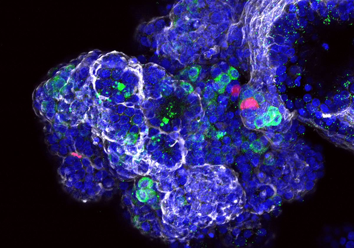 TheCleversLab's tweet card. An innovative organoid model mirrors the pancreas' complexity, generating all three key cell types to explore development and possible regeneration.