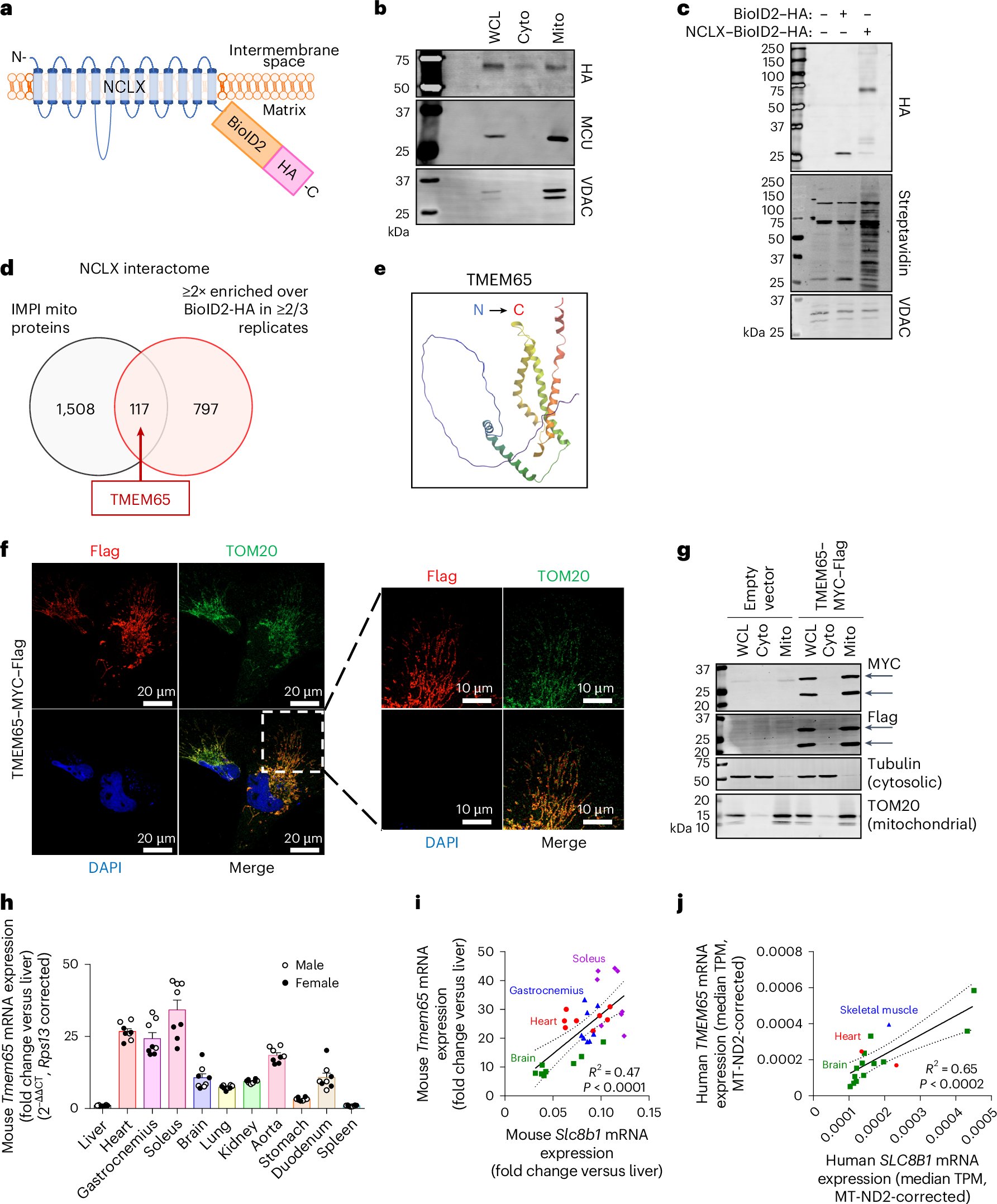 dhtomar's tweet card. Nature Metabolism - Garbincius et al. show that the mitochondrial protein TMEM65 is required to mediate NCLX-dependent mitochondrial calcium efflux, thus fine-tuning mitochondrial function and...