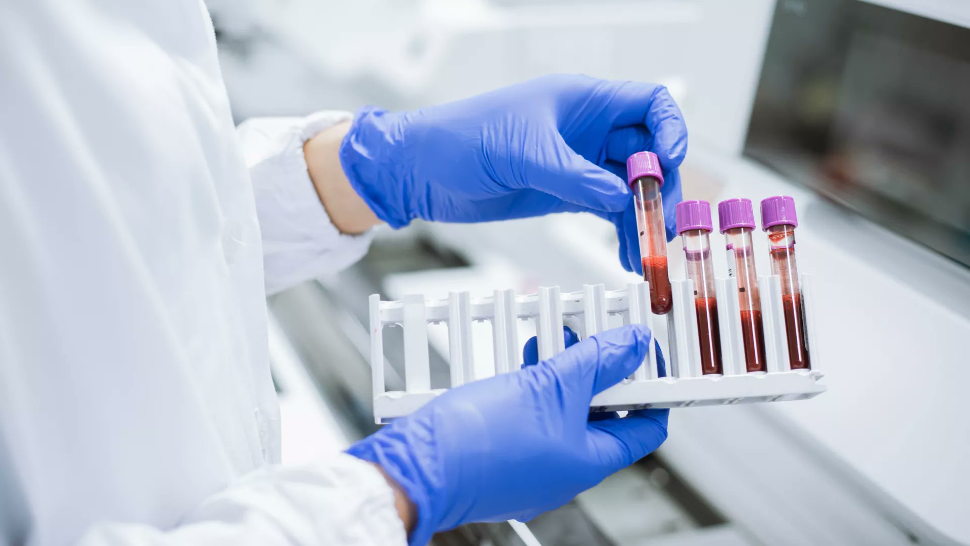 FrontOncology's tweet card. BackgroundCD19-targeted chimeric antigen receptor T (CAR T) cell therapy has revolutionized the treatment of refractory/relapsed B-cell malignancies. However...