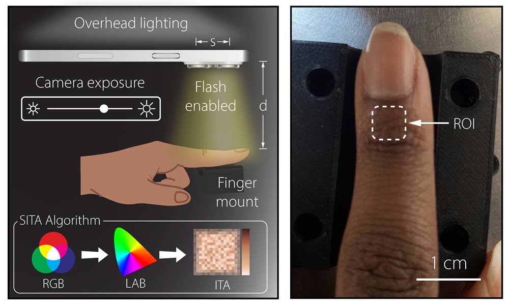 brownengin's tweet card. Researchers show that smartphone cameras can accurately measure skin tone using a standardized color metric, offering a low-cost alternative to clinical devices for improving equity in pulse oximetry
