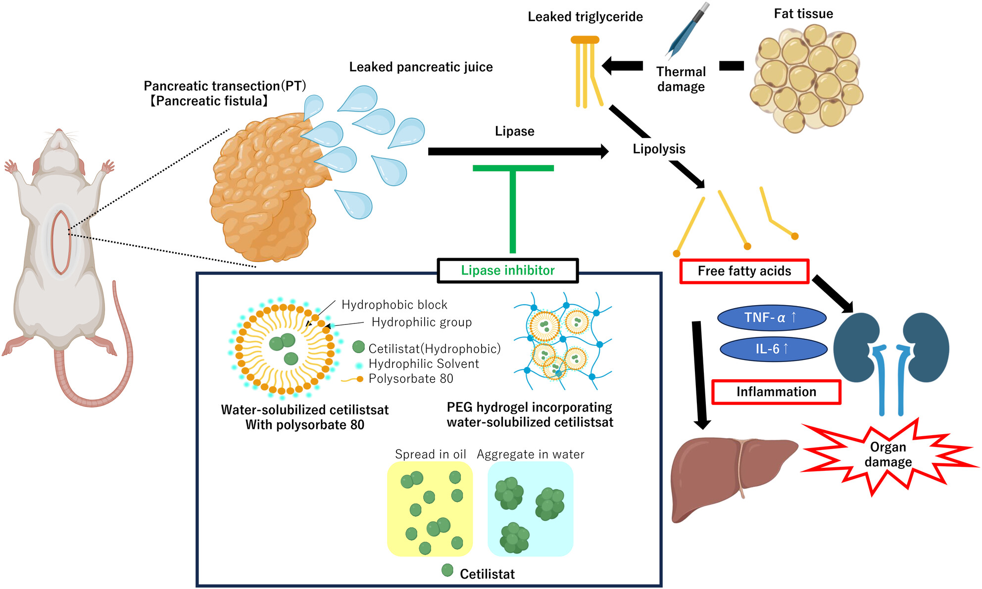 JSHBPS's tweet card. Nakamura and colleagues established a rat model of severe postoperative pancreatic fistula and developed a preventive strategy. Combining pancreatic resection with intra-abdominal fat worsened...