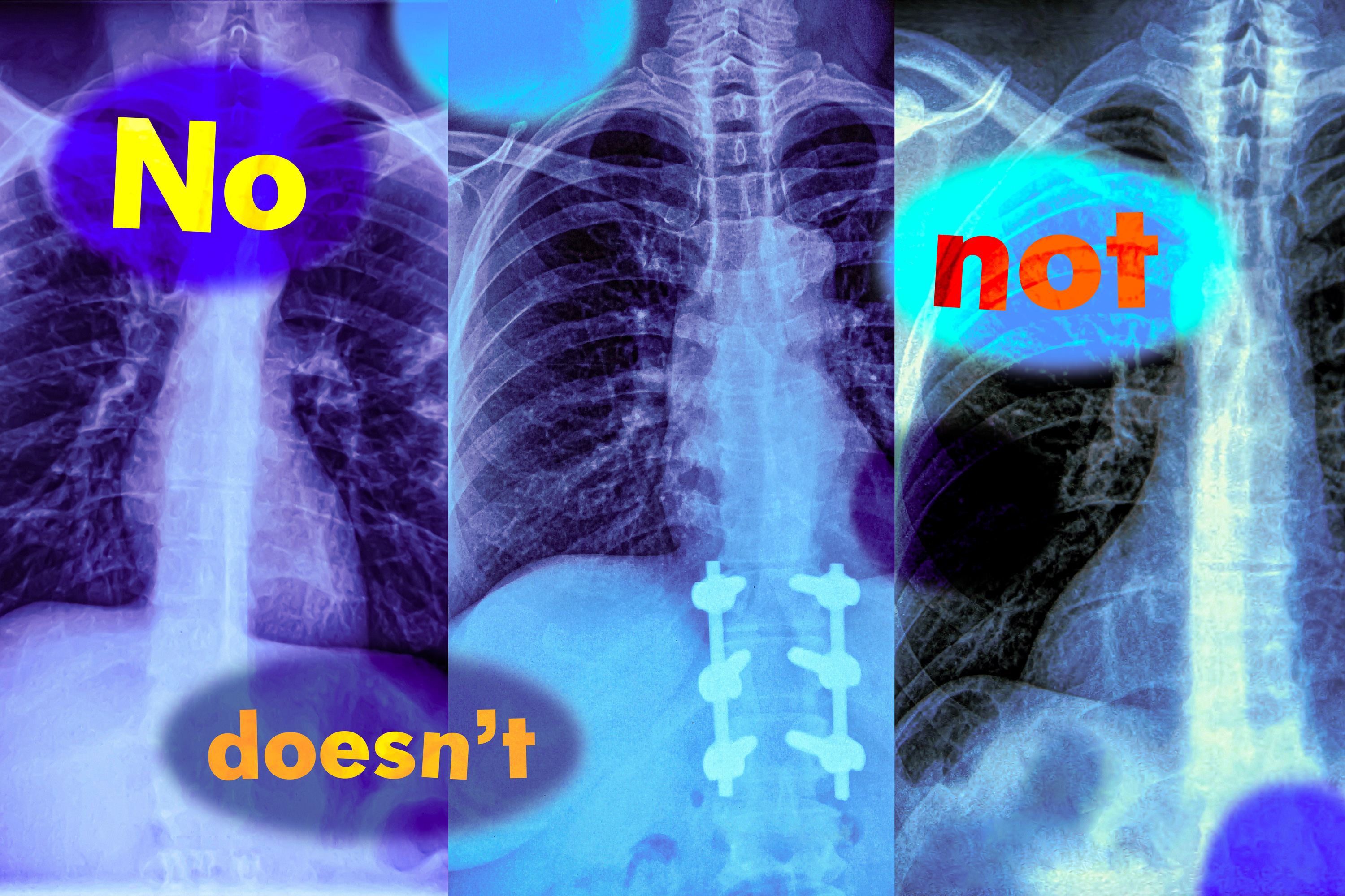 MITLIDS's tweet card. MIT researchers found that vision-language models, widely used to analyze medical images, do not understand negation words like “no” and “not.” This could cause them to fail unexpectedly when asked...