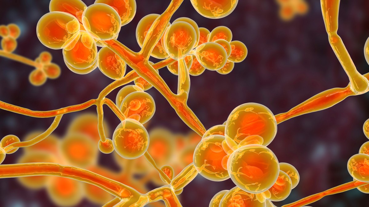 JacquesMeis's tweet card. Dundee University team leading fight against Candida auris, a type of yeast that causes severe illness and spreads easily among hospital and care home patients