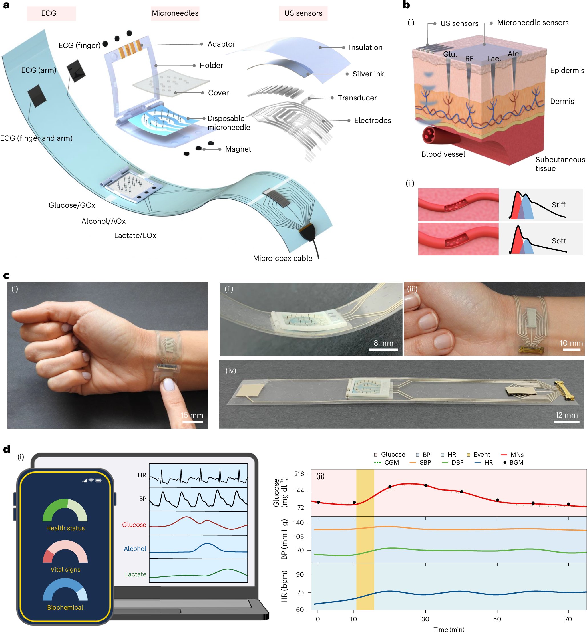 XugroupUCSD's tweet card. Nature Biomedical Engineering - A wristband combines continuous glucose monitoring with real-time detection of physiological signals to track glucose metabolism.