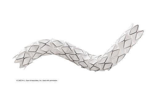 VascularNews's tweet card. Gore today announced CE-mark approval of an expanded indication for the Gore Viabahn VBX balloon-expandable endoprosthesis when used as a bridging stent.
