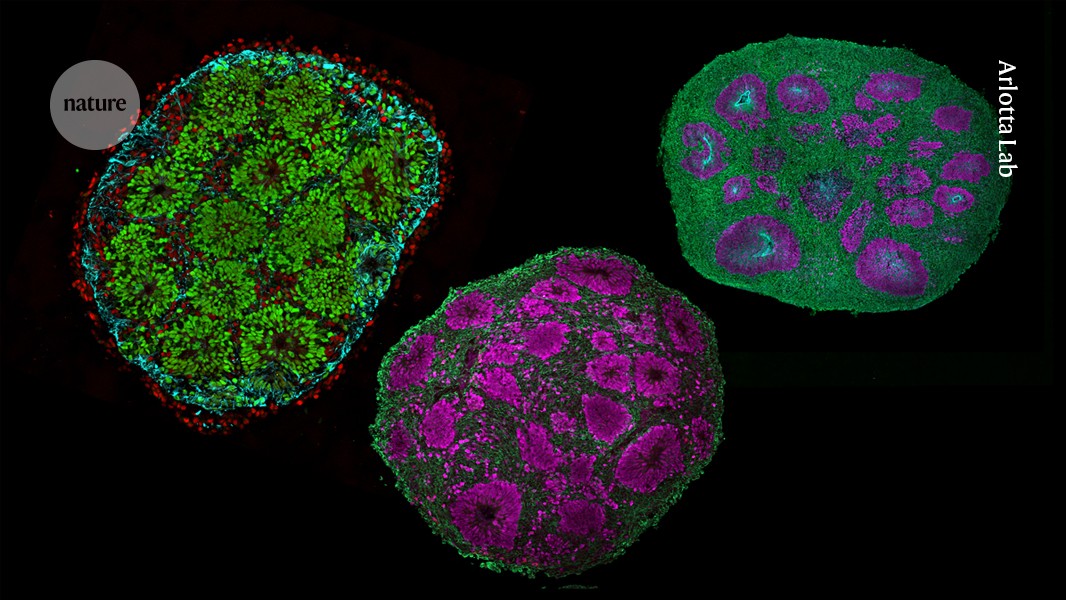 EmoryGenetics's tweet card. Nature - With organoids, assembloids and a growing toolkit of bioengineering tricks, scientists are stitching together models of the developing human brain — and pushing the limits of realism and...