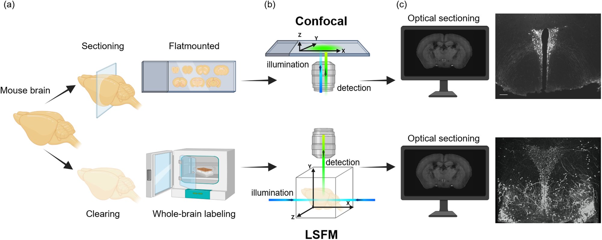 WIMIN_WMIS's tweet card. Molecular Psychiatry - Current and future applications of light-sheet imaging for identifying molecular and developmental processes in autism spectrum disorders