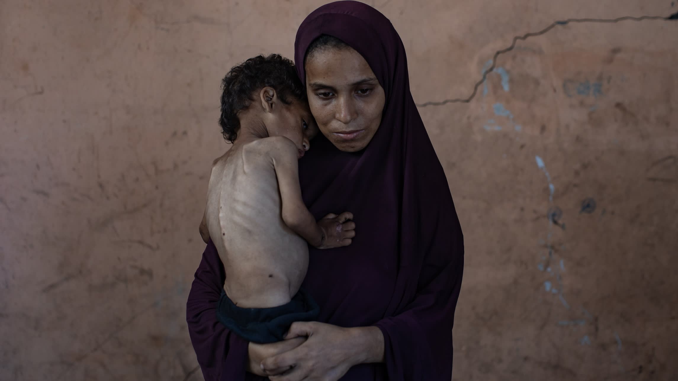 ZiadMDaoud's tweet card. Health ministry says dozens have died this month as aid agencies warn that even their workers are suffering from malnutrition