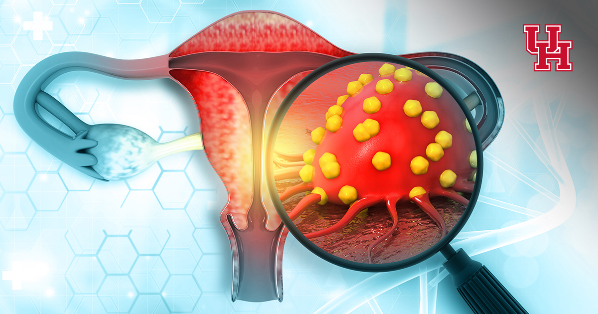 UH_News's tweet card. With a $1.2M grant from @DeptofDefense, an engineer @UHouston leads a team to find early markers for ovarian cancer, a deadly threat because it is difficult to detect early.