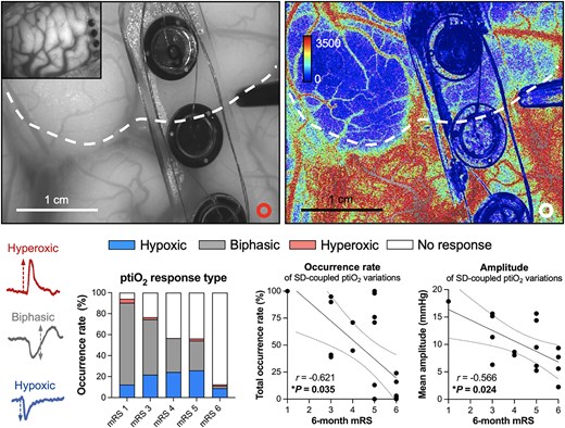 vajkoczy's tweet card. Hecht et al. performed side-by-side monitoring of spreading depolarizations and brain tissue oxygen in patients suffering large ischaemic stroke. They conc