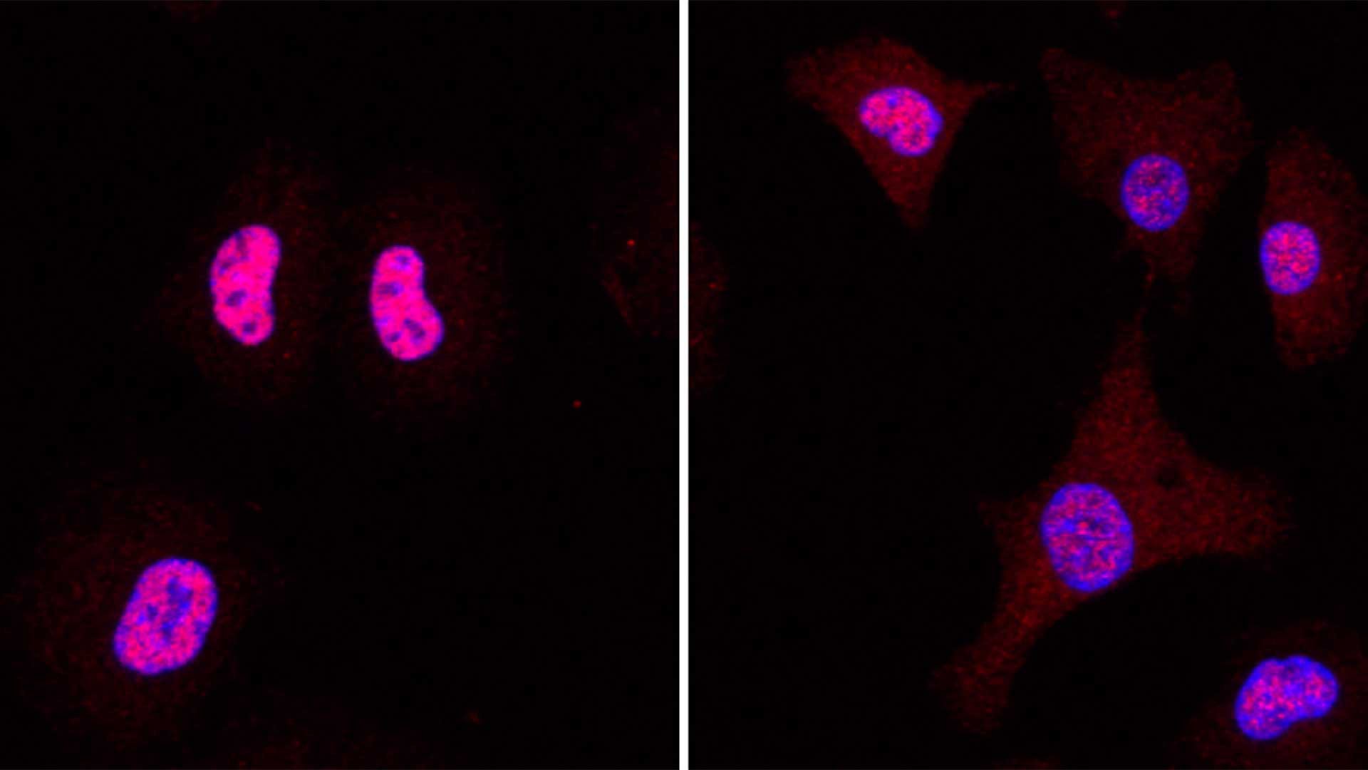 CSHL's tweet card. If there’s one thing cancer knows, it’s growth. Over the last two decades, scientists have observed that many cancers progress by activating a set of proteins called YAP and TAZ, which control cell...