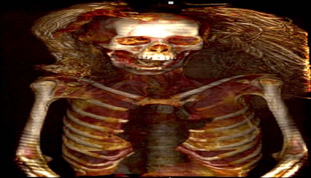 NatureMEast's tweet card. A new study reveals that the 3,500-year-old mummy probably faced a painful death that left her screaming in agony, rather than a rushed embalming process.