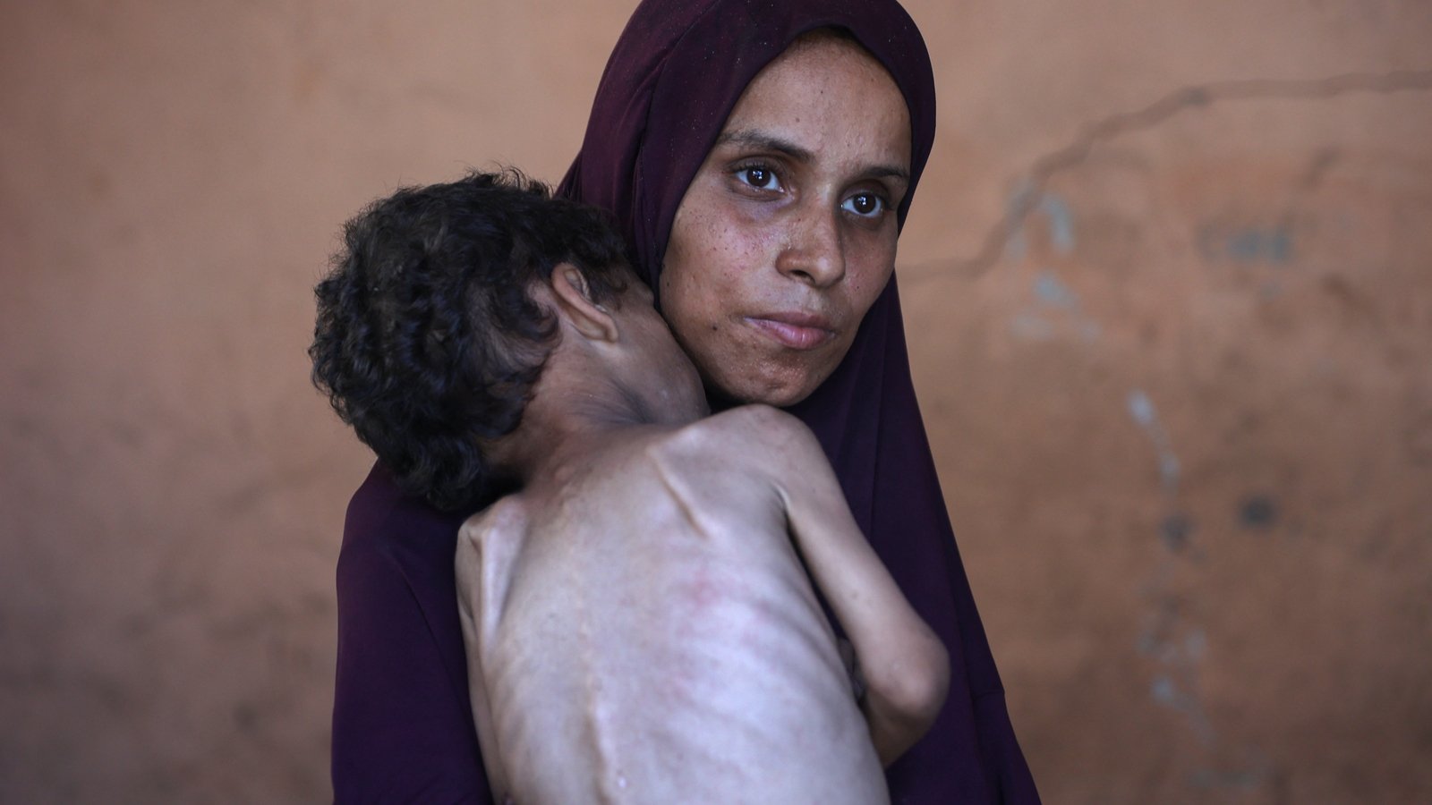 OxfamIreland's tweet card. The Director-General of the World Health Organization has said that a "large proportion of the population in Gaza is starving".