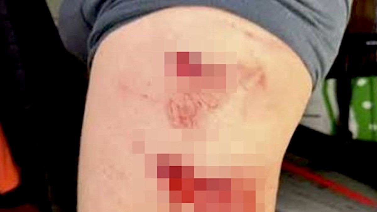 Surfer's tweet card. A UK man was downwind foiling when he was attacked by a suspected mako shark off Fuerteventura.
