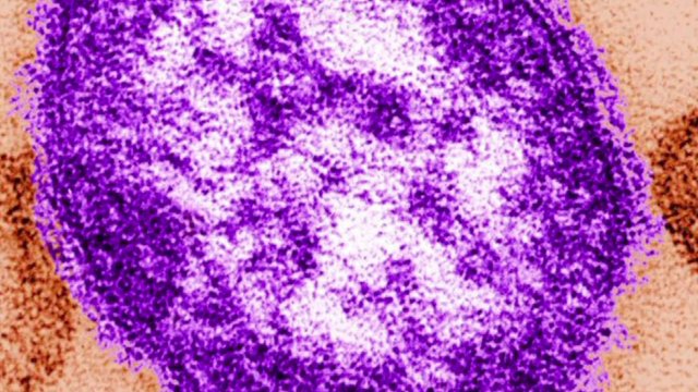 kfor's tweet card. The Oklahoma State Department of Health (OSDH) has confirmed 20 measles cases in Oklahoma, as of July 22.