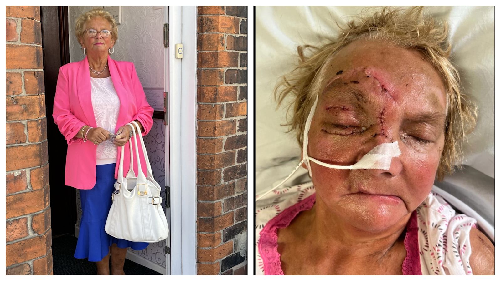 GranadaReports's tweet card. Pensioner Margaret Scaldwell suffered life changing injuries after an e-bike driven by Kian Monks knocked her down as she crossed the road in Wigan | ITV News Granada