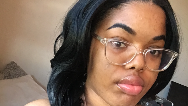 NLH2224's tweet card. Hi, my name is Nathan hill, and I'm fundraising for my girlfriend, who's… Nathan Hill needs your support for Urgent Dental Care Needed for Nathan's Girlfriend