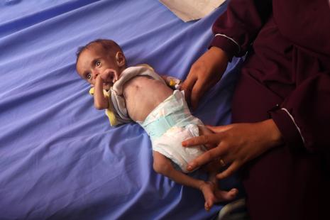 leQdM's tweet card. Plus d’une centaine d’organisations non gouvernementales (ONG), dont Médecins du monde, Médecins sans frontière, Amnesty international et Oxfam international, sonnent l’alerte dans un communiqué,...