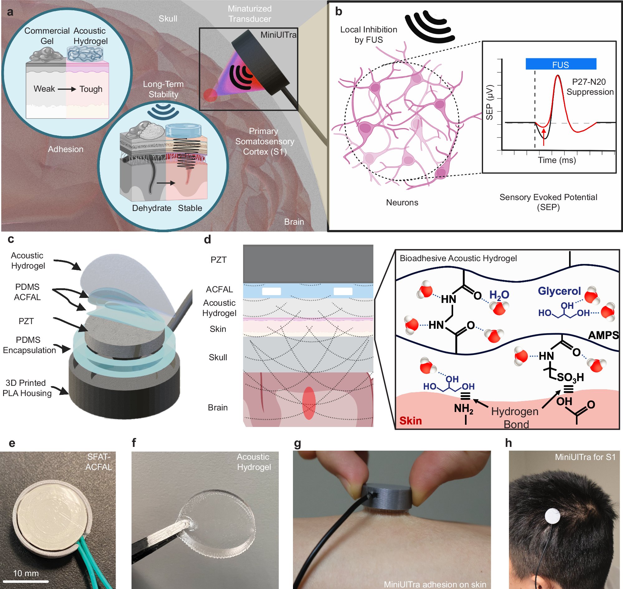 whl0903's tweet card. Nature Communications - Transcranial focused ultrasound can be used for neuromodulation, but its use in wearable systems remains challenging. The authors present a miniaturised wearable ultrasound...